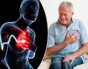 همه چیز درباره حمله قلبی Heart Attack ؛ هر ۲۰ ثانیه یک حمله قلبی در جهان | کافه پزشکی