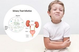 عفونت مجاری ادراری در کودکان چگونه درمان می شود ؟ | کافه پزشکی