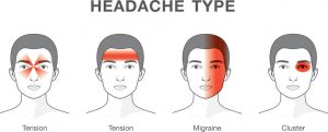 همه چیز درباره سردرد میگرن Migraine ؛ سومین بیماری رایج جهان | کافه پزشکی