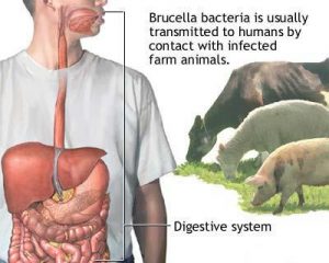 بیماری تب مالت (Brucellosis) ؛ علائم، علل و درمان آن | کافه پزشکی