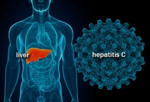 همه چیز درباره هپاتیت C ؛ عامل مرگ و میر سالانه حدود ۴۰۰ هزار نفر در جهان | کافه پزشکی