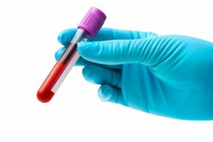 آزمایش خون: شمارش کامل سلول های خون CBC | کافه پزشکی