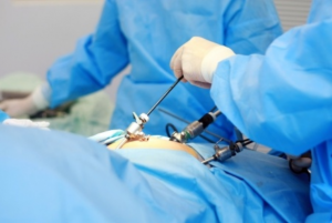 نکات بیهوشی در جراحی لاپاراسکوپی | کافه پزشکی