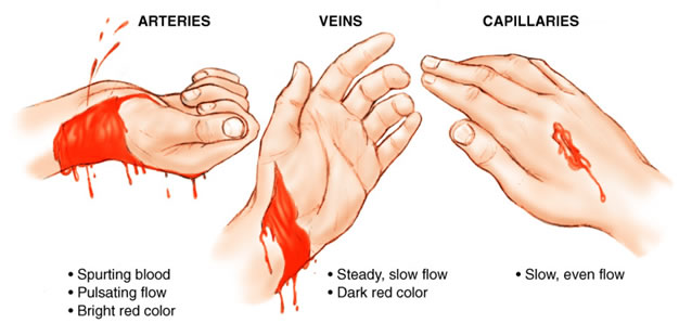 انواع خونریزی