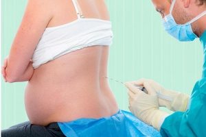 بیهوشی در دوران بارداری و زایمان | کافه پزشکی