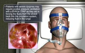اورژانس تنفس ؛ چگونگی برخورد با آسیب های ریوی و نکات اعزام | کافه پزشکی