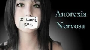 اختلال بی اشتهایی عصبی یا Anorexia Nervosa | کافه پزشکی