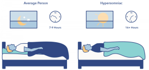 اختلال هایپرسومنیا Hypersomnia ؛ خواب آلودگی مفرط با وجود بیش از ۱۲ ساعت خواب روزانه ! | کافه پزشکی