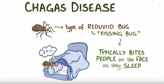 بیماری شاگاس