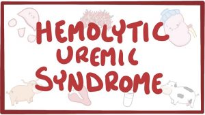 سندروم همولیتیک اورمیک (HUS) ؛ علائم، علل، تشخیص و درمان | کافه پزشکی